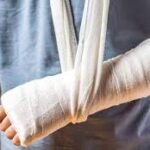 Fractures: Types, Symptoms, Causes & More