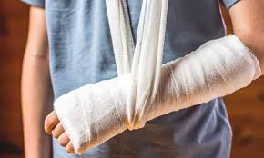 Fractures: Types, Symptoms, Causes & More
