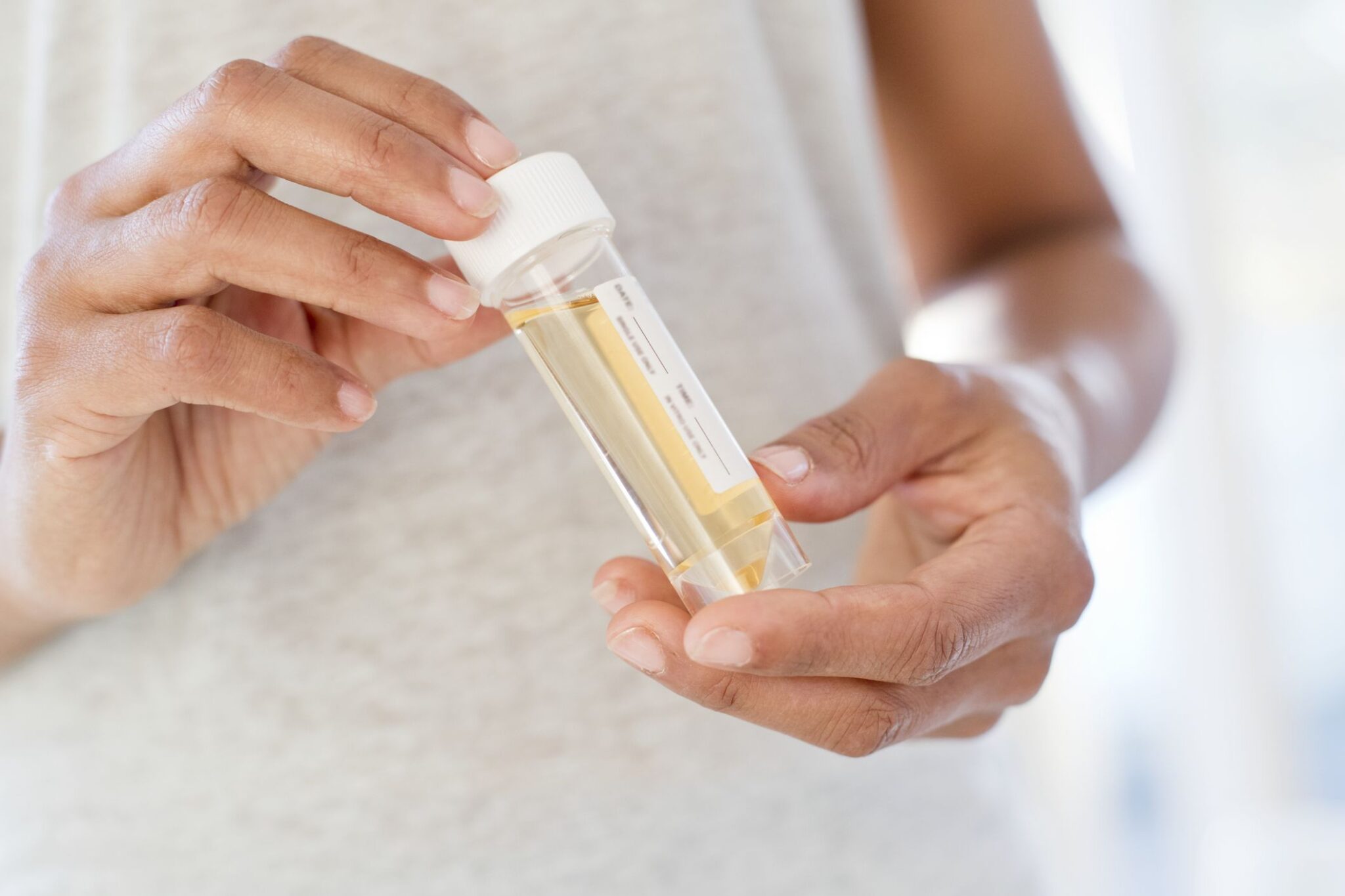 What Is Urine Infection How To Avoid This Medrot
