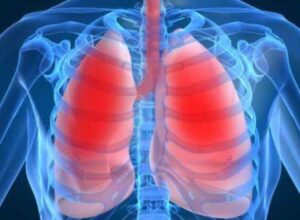 The Respiratory System's Effects
