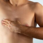 Male Breast Cancer