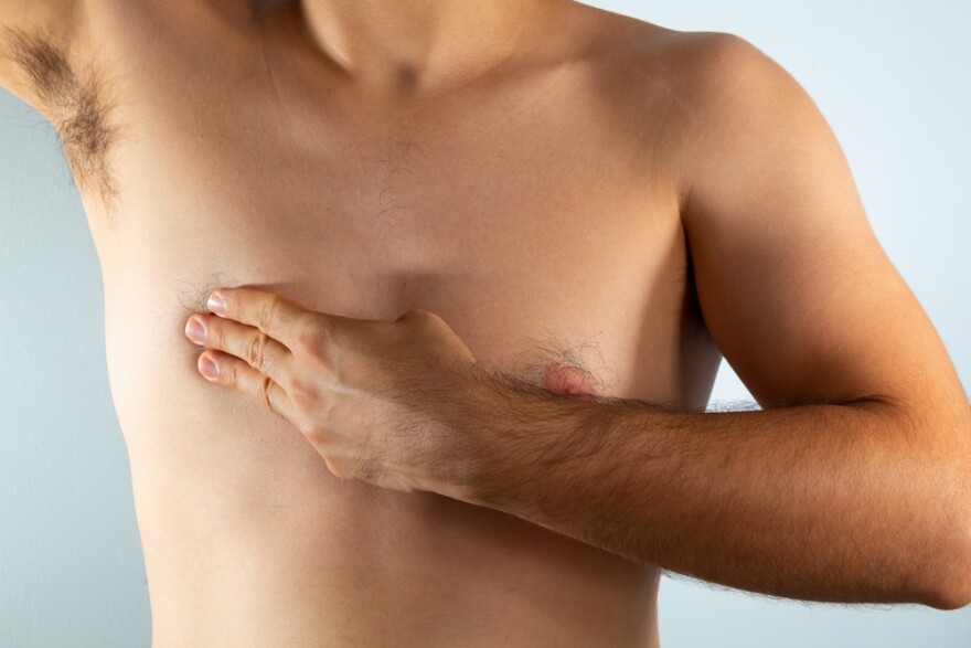 Male Breast Cancer