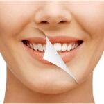 teeth_whitening