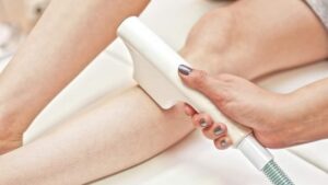 Laser Hair removal