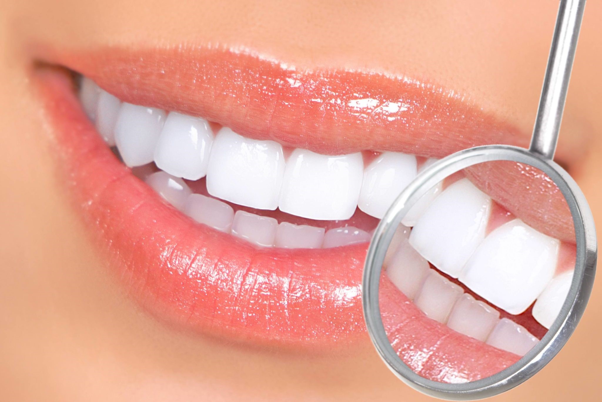 Teeth Whitening