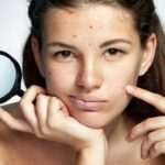 blemishes