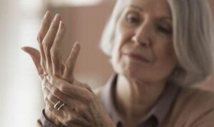 Arthritis and Osteoporosis
