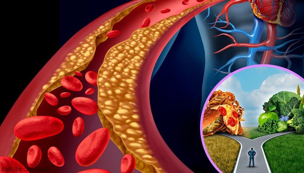 Cholesterol