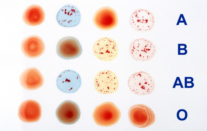 A, B, AB, and O Blood Types Explained