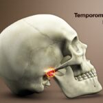 Temporomandibular Joint Disorders