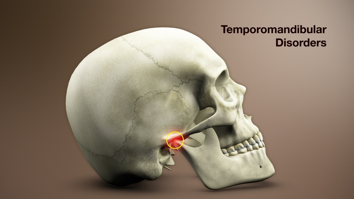 Temporomandibular Joint Disorders