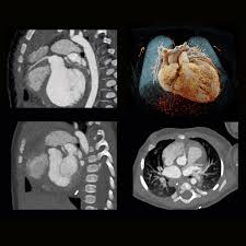 Cardiovascular scanner for heart