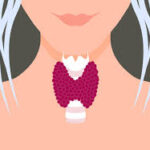 Symptoms and causes of hypothyroidism