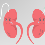 Kidney disease: Symptoms, causes, and treatment