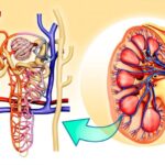 Urology and Nephrology- Urinary and Renal Problem solutions