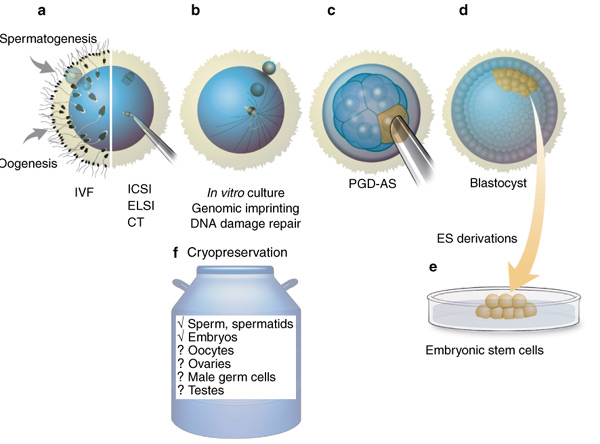 IVF treatment - Egg Vitrification