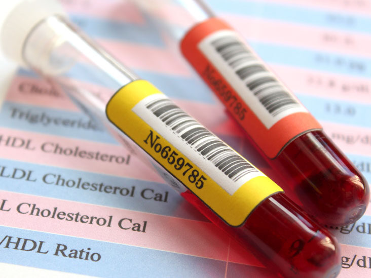How is total cholesterol or blood cholesterol test performed?