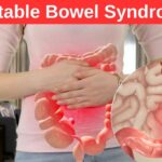 How can irritable bowel syndrome be treated most effectively?