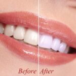 How To Whiten Your Teeth Naturally at Home