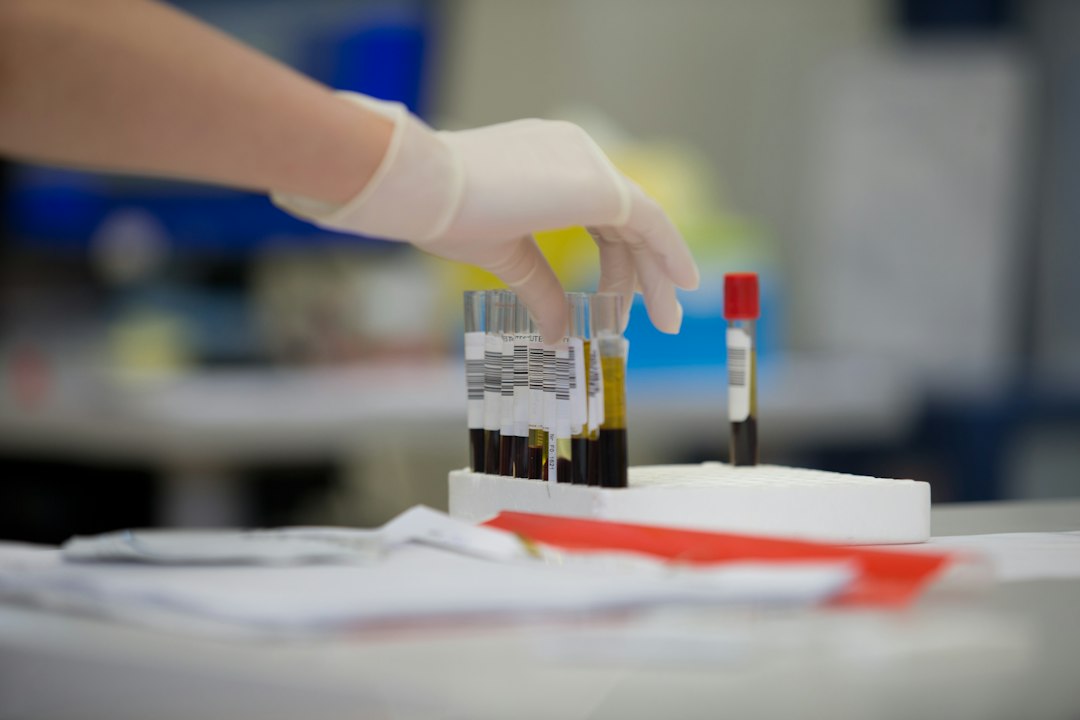 Medical laboratory blood sample testing for possible vitamin B12 deficiency